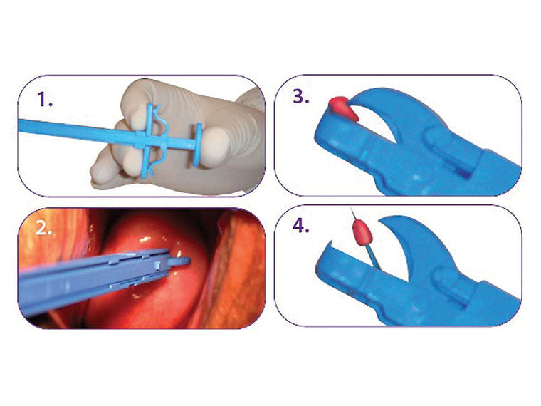 CERVICAL Biopsitång 21,5 cm - steril - 25 st/förpackning