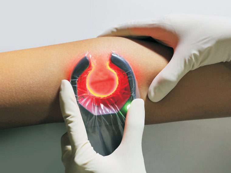 VEINSPY VEIN FINDER - Visualisering av vener