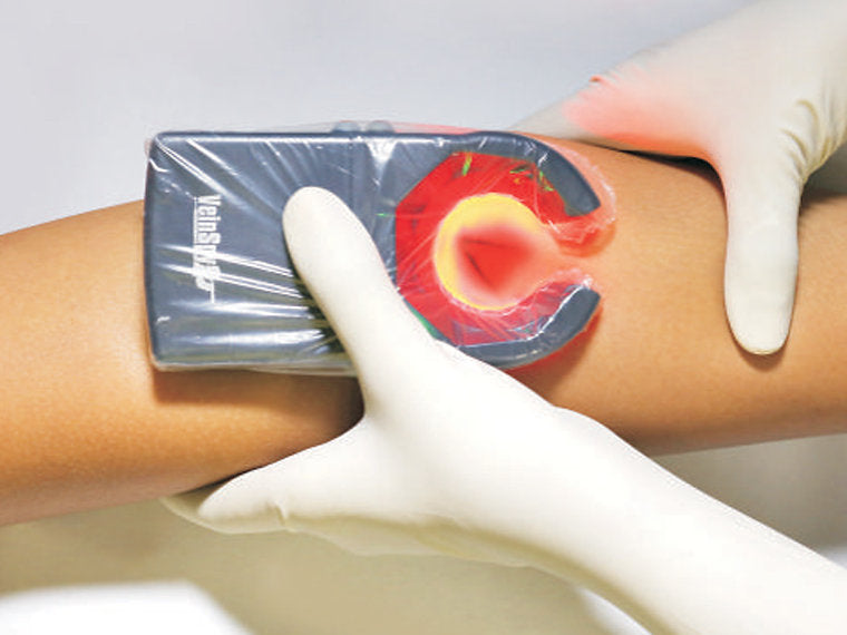 VEINSPY VEIN FINDER - Visualisering av vener