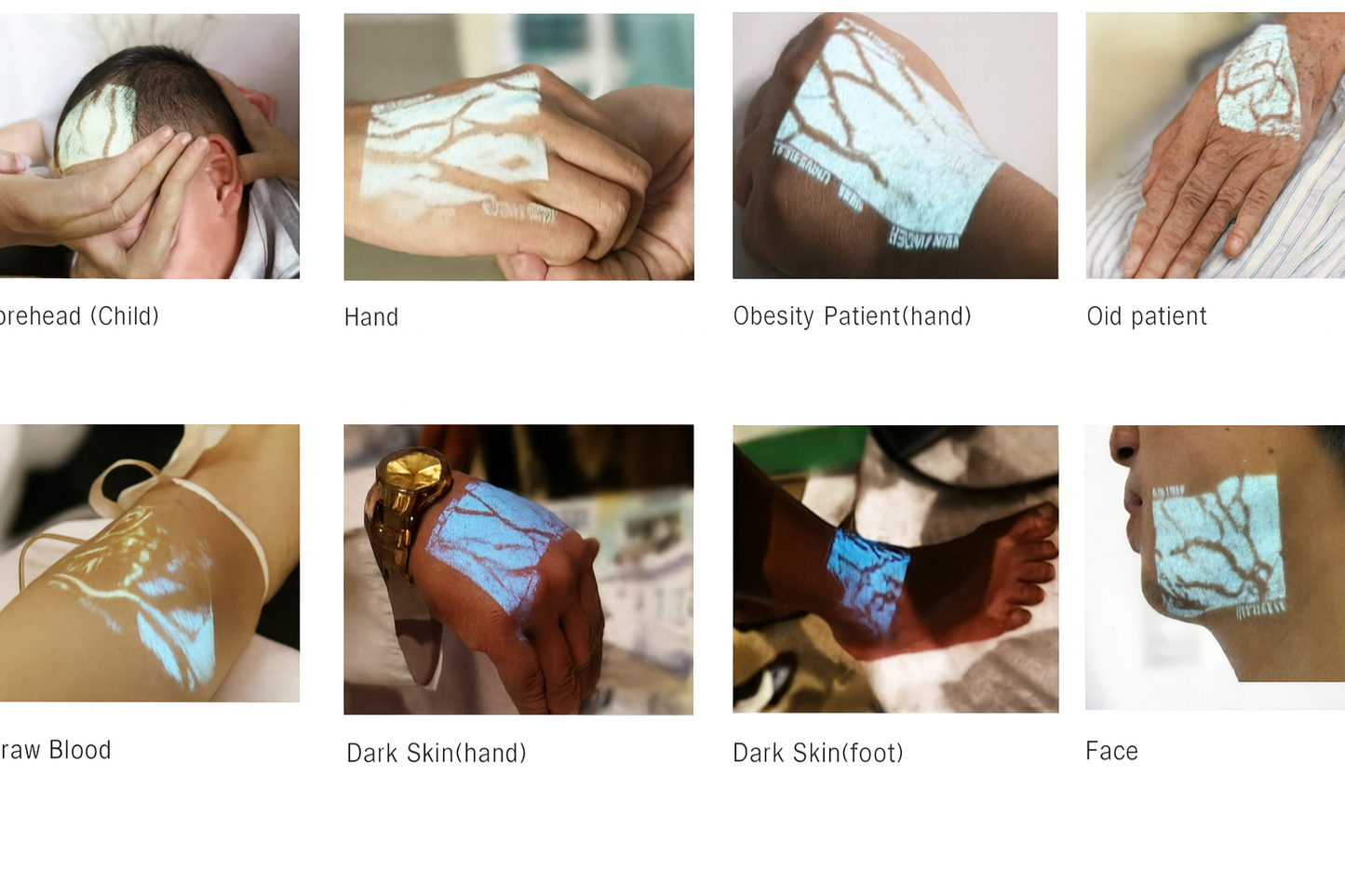 Venscanner VeinSight VS500