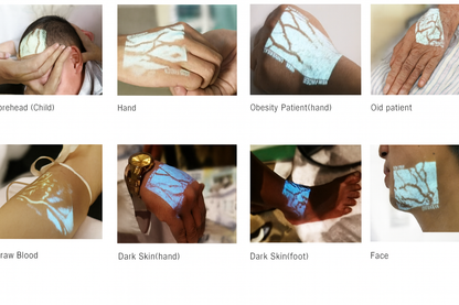 Venscanner VeinSight VS500