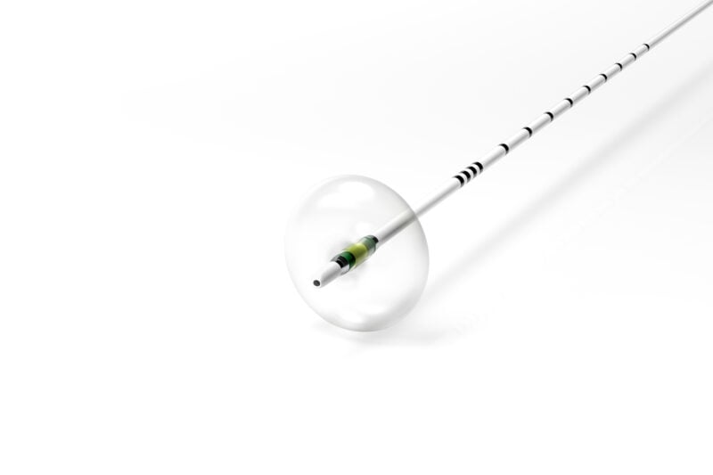 Ballongkateter för stenextraktion – Minimize
