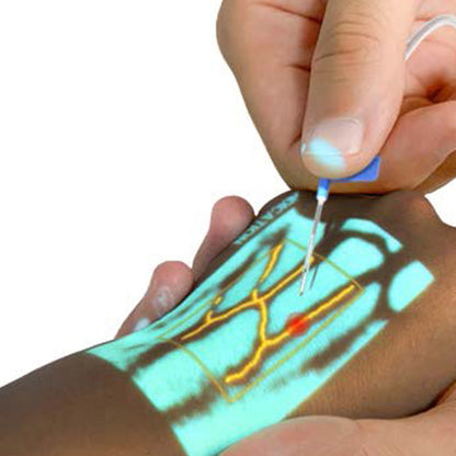 Venscanner VeinSight VS500