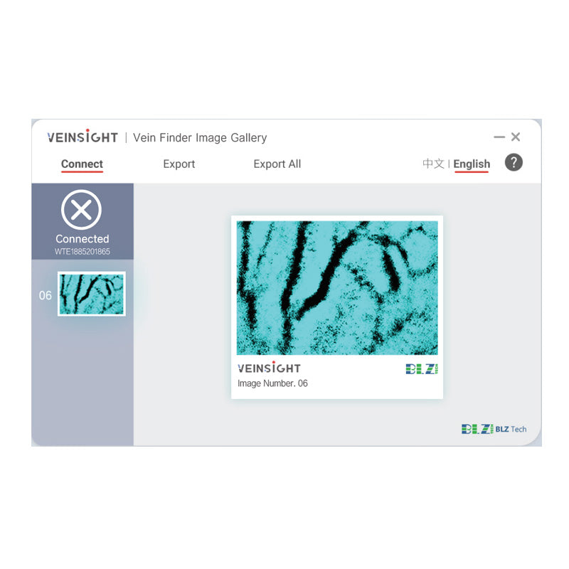 Venscanner VeinSight VS500