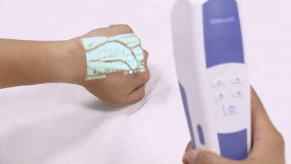 Venscanner VeinSight VS500